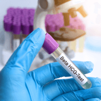 Beta HCG Pregnancy Test
