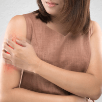 Dermatology Blood Test