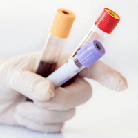 General Health Screen Blood Test