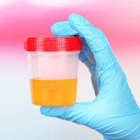 Urinalysis Testing at BloodHub
